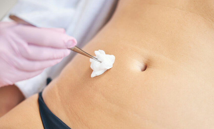 Bariatric Surgery